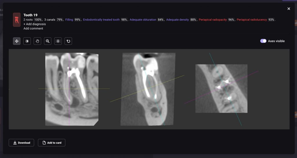 Radiologischer Bericht 3
