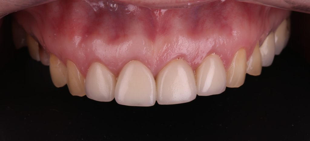 Correcting pink aesthetics 1