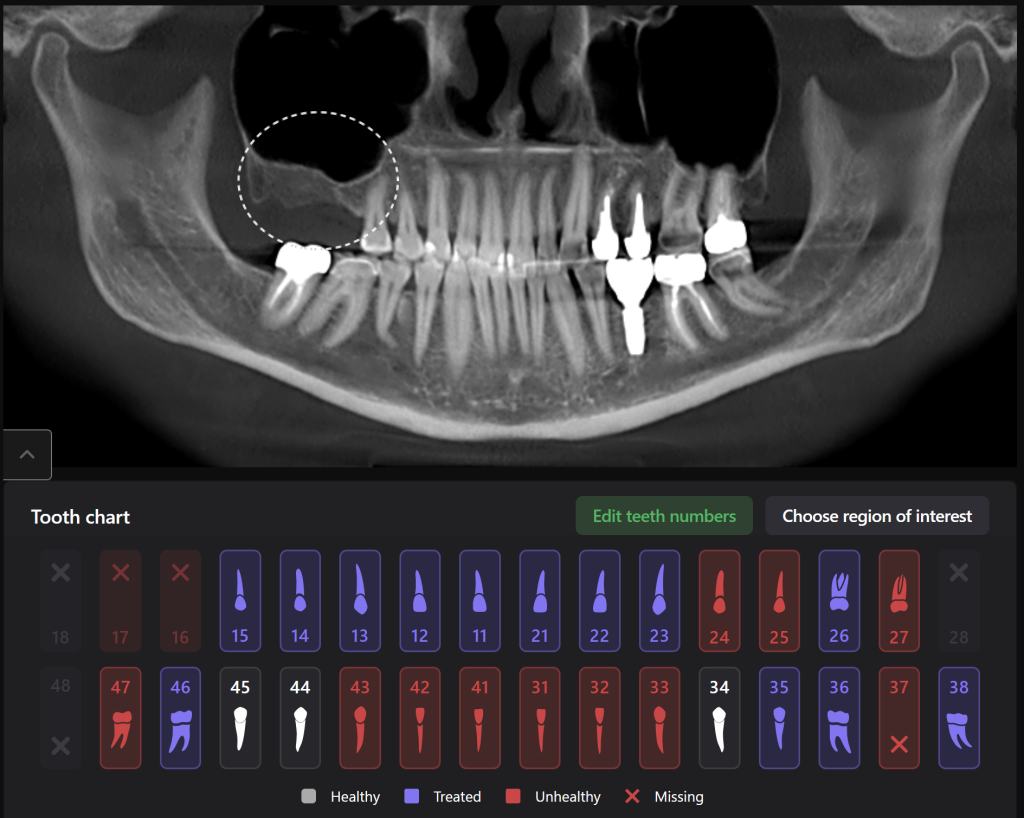 Implant treatment planning 1