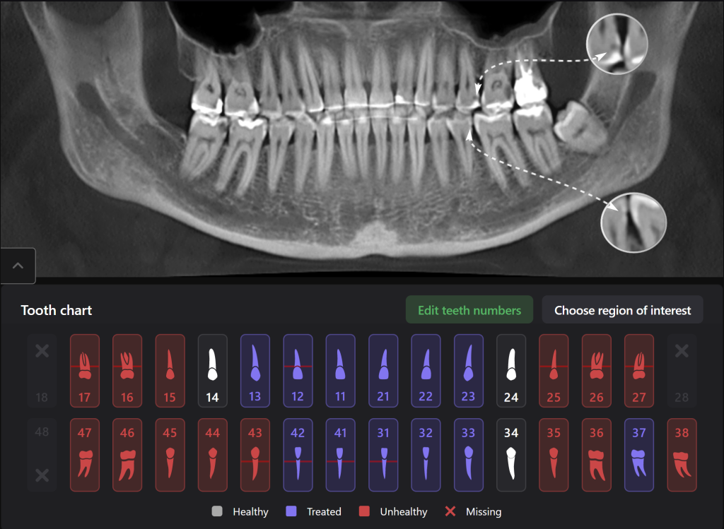 Diagnocat - your virtual dental assistant 1
