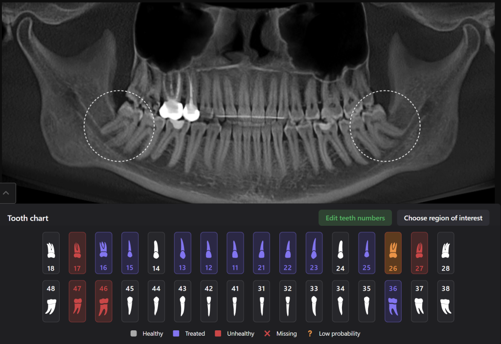 Case study - Treatment plan for atraumatic extractions 1