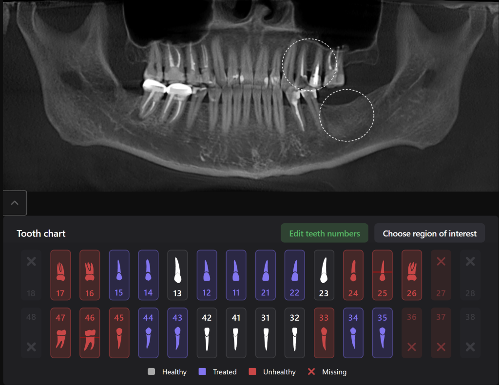 Implantologie mit Diagnocat-Modulen 1