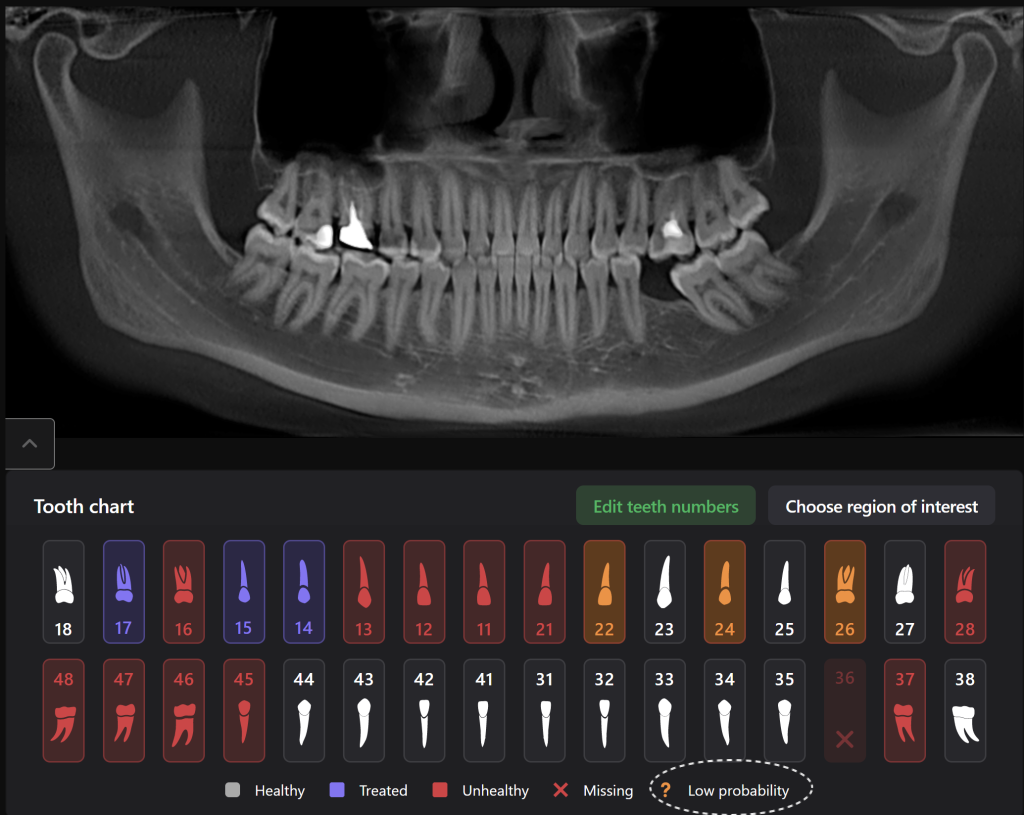 Diagnocat's radiological report - special features 1
