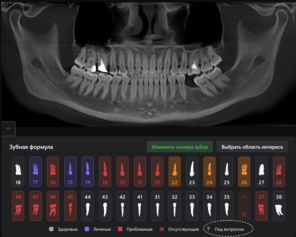 Рентгенологический отчет Diagnocat - особые возможности 1