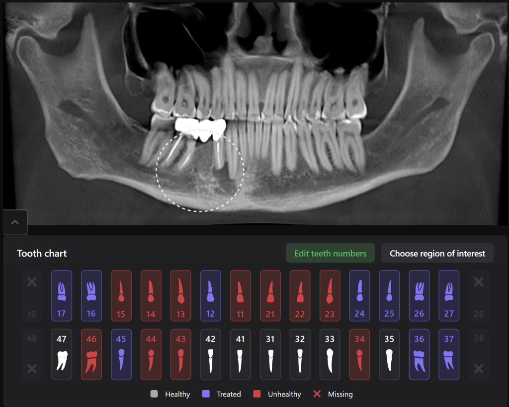 AI Diagnocat-supported case study 1
