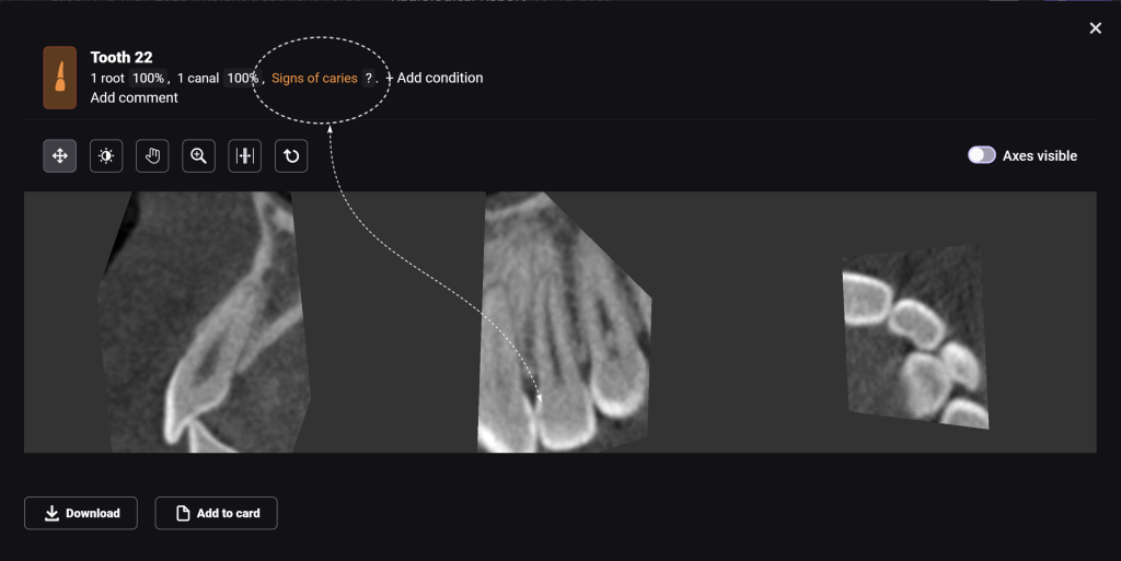 Diagnocat's radiological report - special features 3