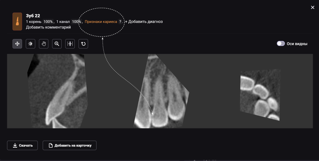 Рентгенологический отчет Diagnocat - особые возможности 3
