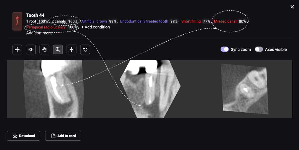 AI Diagnocat-supported case study 3