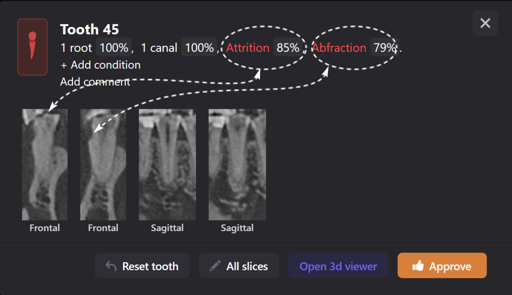 Total prosthetic rehabilitation - case study 5