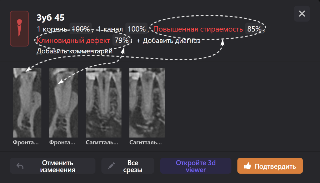Случай из практики - планирование тотальной ортопедической реабилитации 5
