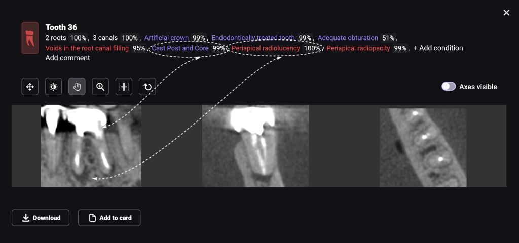 Total prosthetic rehabilitation - case study 7