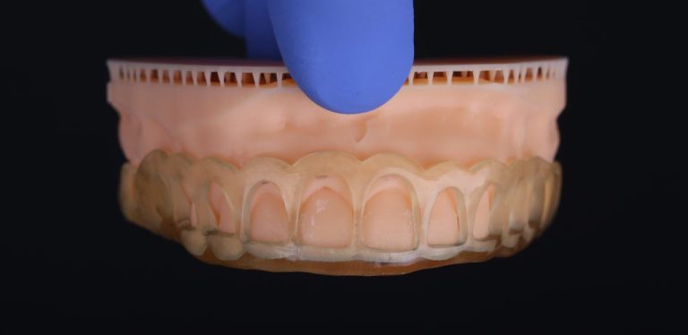 teeth