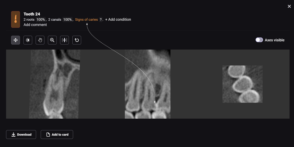 Diagnocat's radiological report - special features 7