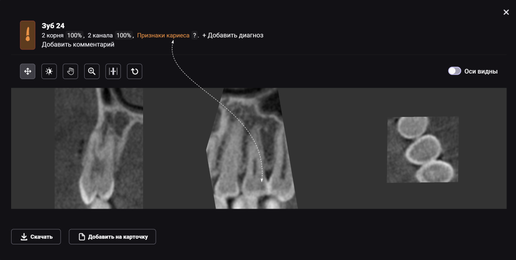 Рентгенологический отчет Diagnocat - особые возможности 7