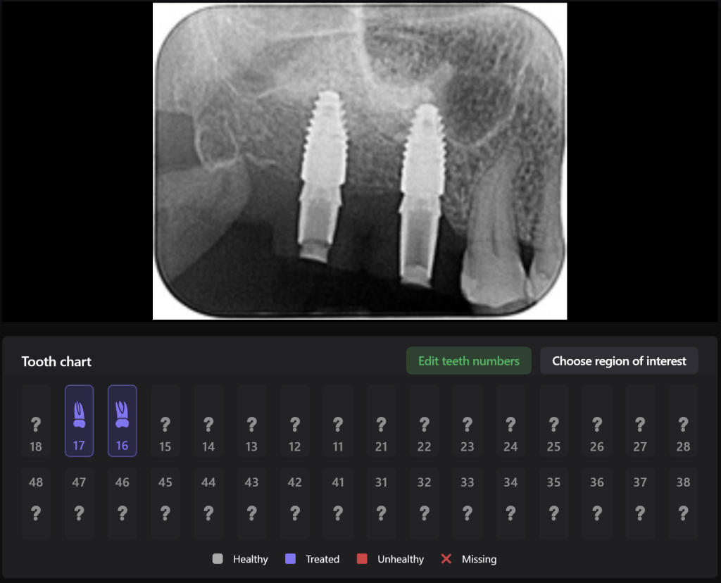 Implant treatment planning 9