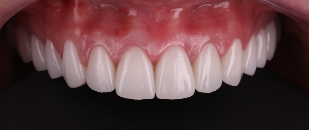 Correcting pink aesthetics 11