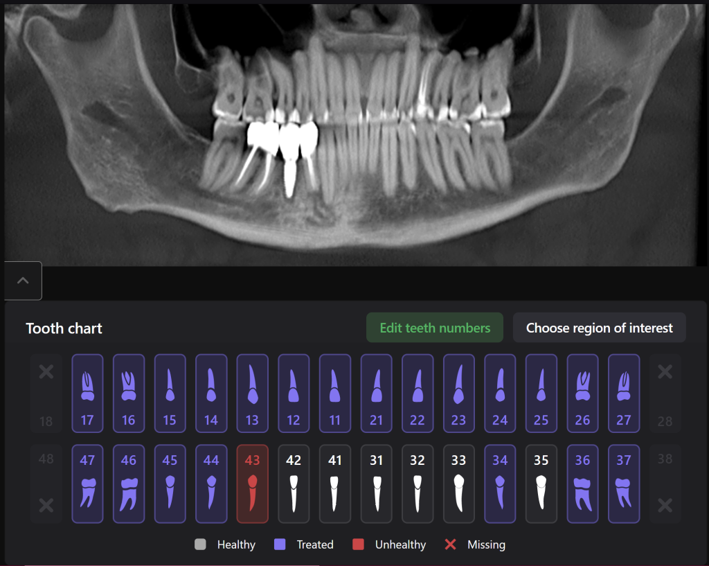 AI Diagnocat-supported case study 11
