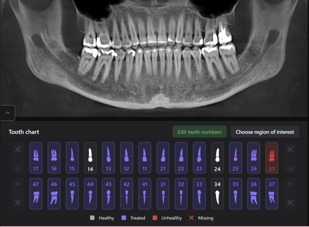 Diagnocat - your virtual dental assistant 11