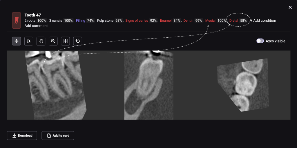 Diagnocat's radiological report - special features 11