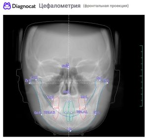 3D modal