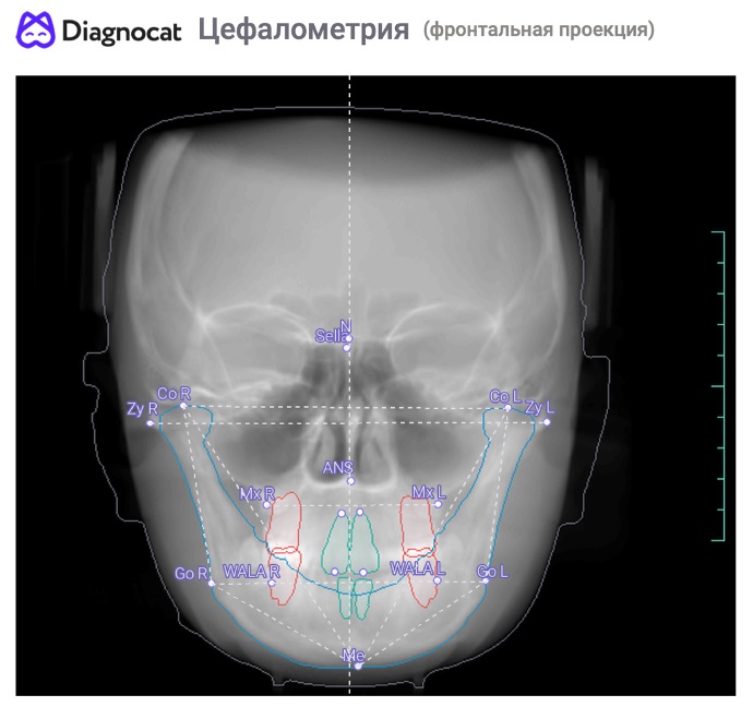 3D modal