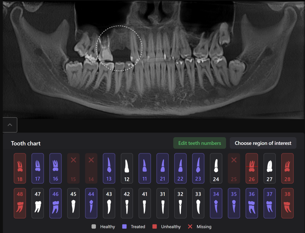 Implantatplanung mit Diagnocat KI 1