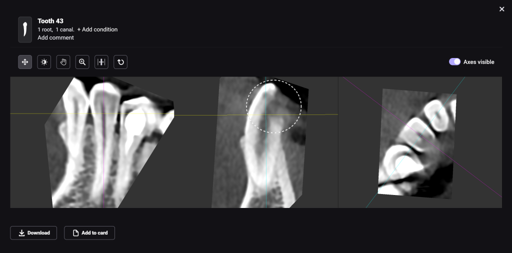 Artifact or true pathology? Let's see! 3