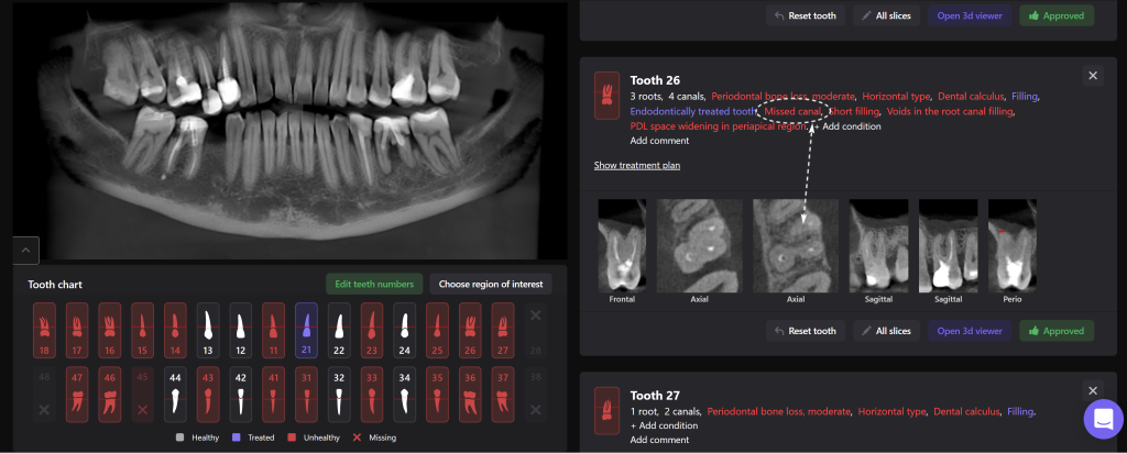 Study root canal morphology and anatomy with Diagnocat 3