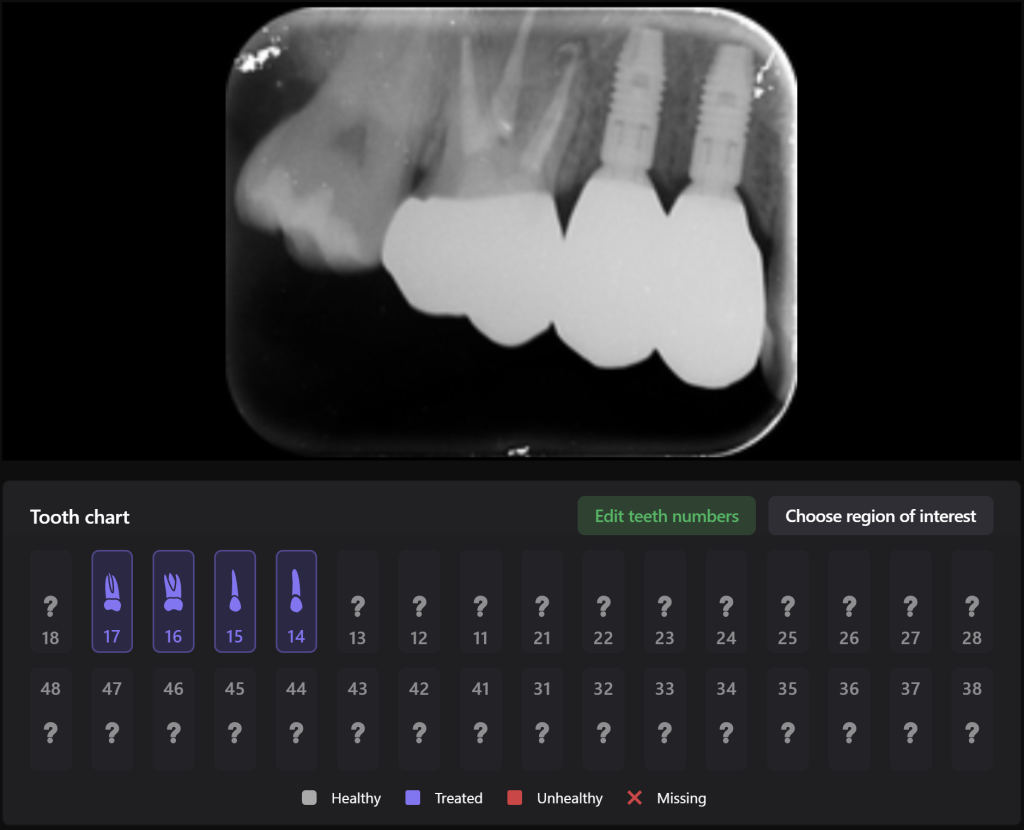 Implantatplanung mit Diagnocat KI 11