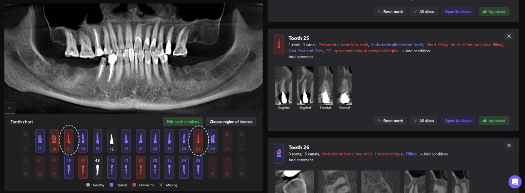 Einfache Implantatplanung mit dem Modul Diagnocat STL 1