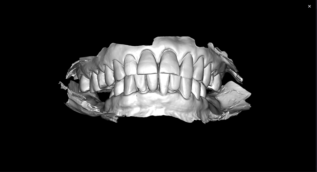 Einfache Implantatplanung mit dem Modul Diagnocat STL 3