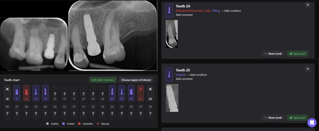 Einfache Implantatplanung mit dem Modul Diagnocat STL 7