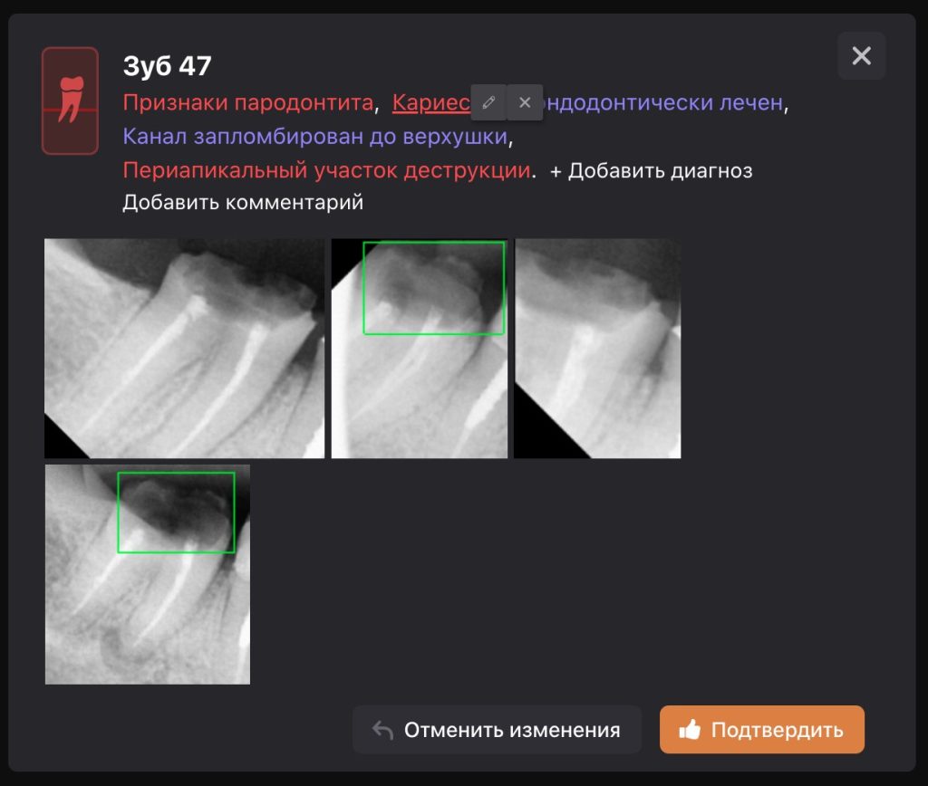 Рентгенологический отчет 10