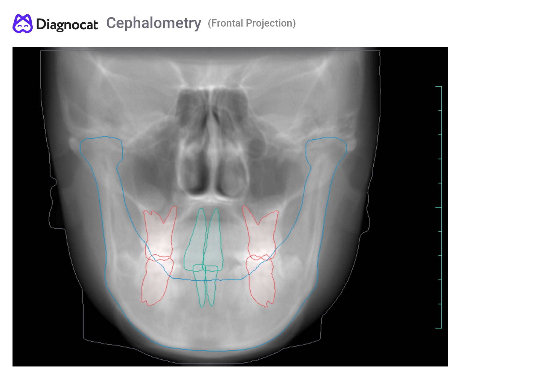 ortho report eng4