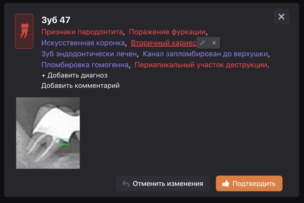Рентгенологический отчет 16