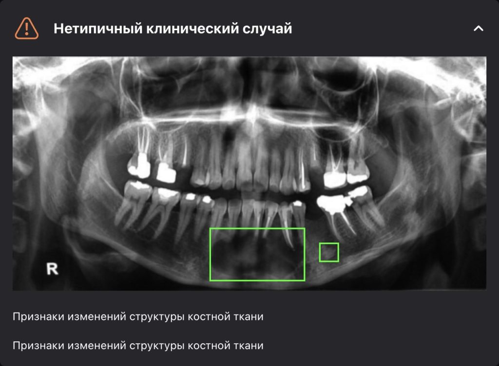 Рентгенологический отчет 18
