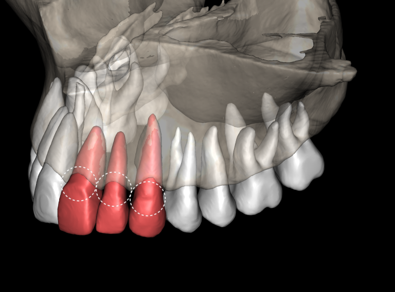 3D modal