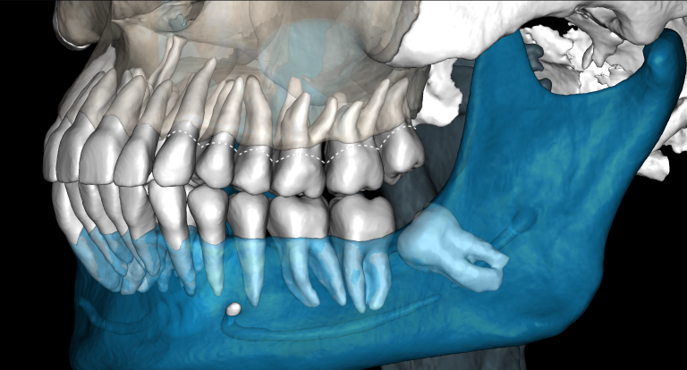 3D modal