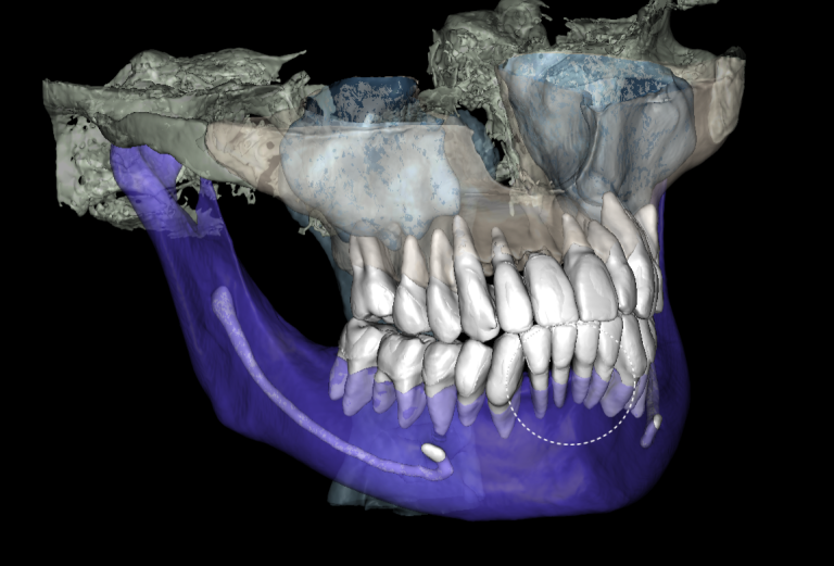 3D modal